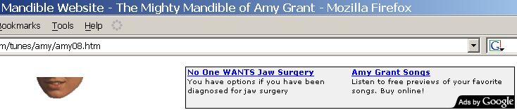 No One WANTS Jaw Surgery